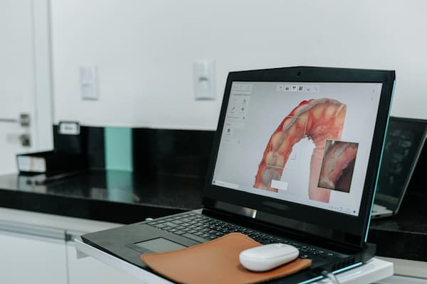Full-Mouth Oral Rehabilitation
